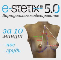 Е-Stetix - 3D-моделирование пластических операций